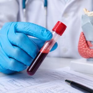 What Does TSH w/Reflex to FT4 Mean? Thyroid Results Explained 