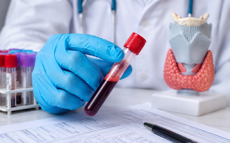 What Does TSH w/Reflex to FT4 Mean? Thyroid Results Explained 